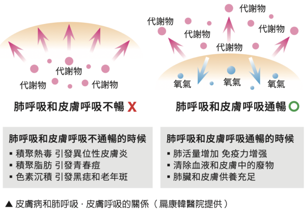 異位性皮膚炎